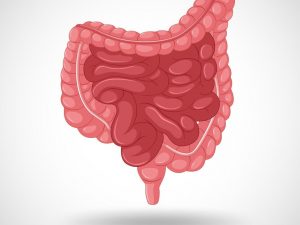 Penyakit Radang Usus yang Sulit Dibedakan – Penyakit Crohn vs Kolitis Ulseratif