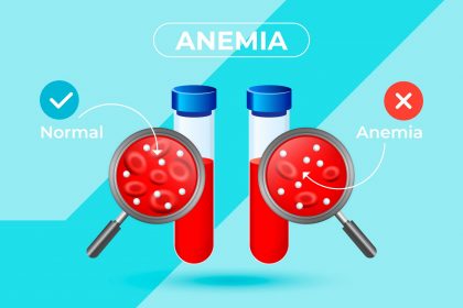 Waspada Anemia, Kekurangan Darah Bisa Ganggu Fungsi Otak!