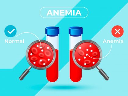 Waspada Anemia, Kekurangan Darah Bisa Ganggu Fungsi Otak!